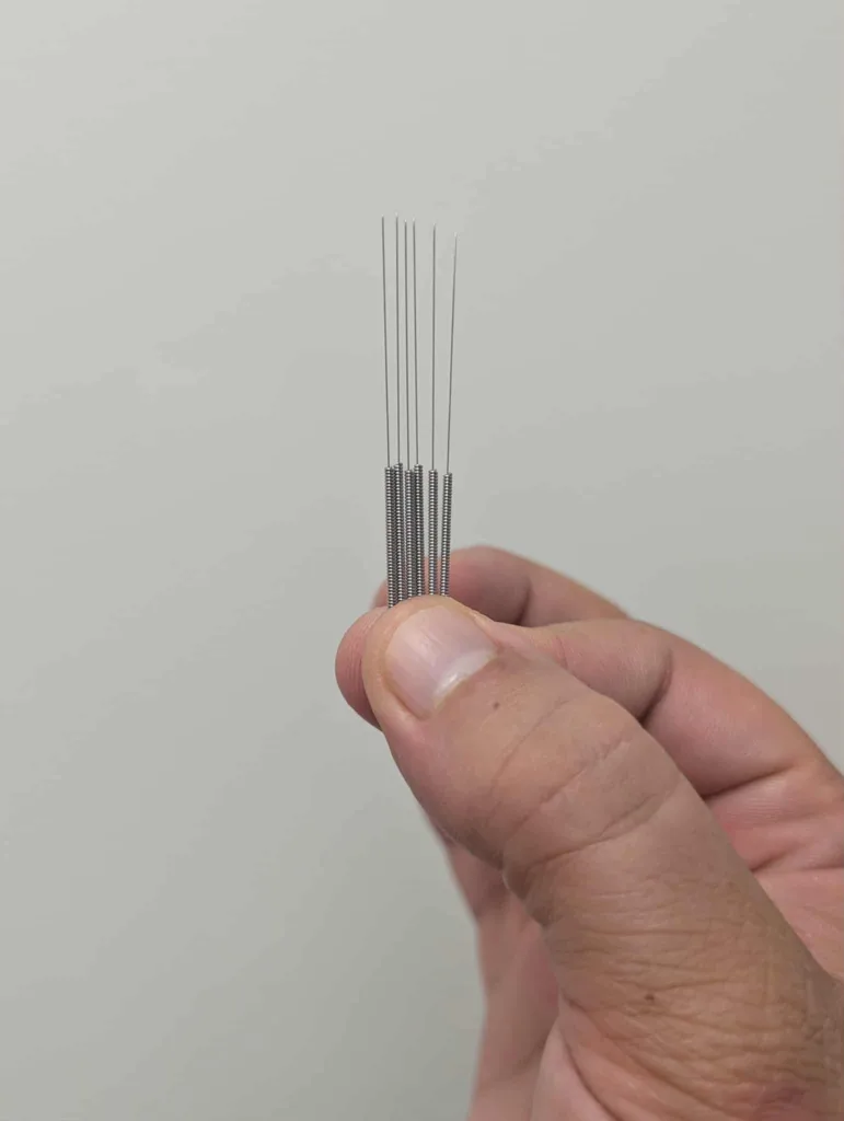 Acupuncture needles used for pain management treatments at Big Easy Acupuncture in Metairie, LA