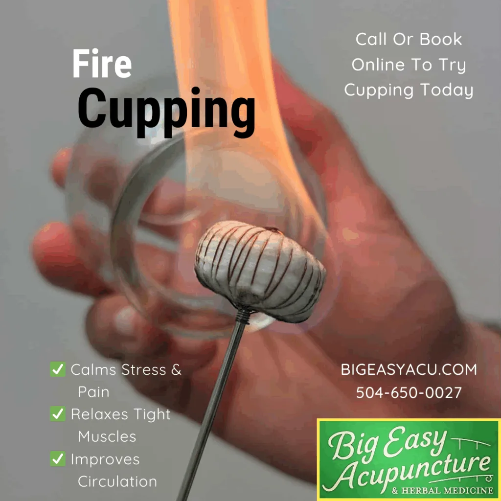 A close-up of fire cupping therapy showing a flame warming a glass cup before placement on the skin — promoting relaxation, improved circulation, and muscle relief at Big Easy Acupuncture & Herbal Medicine in Metairie, LA.